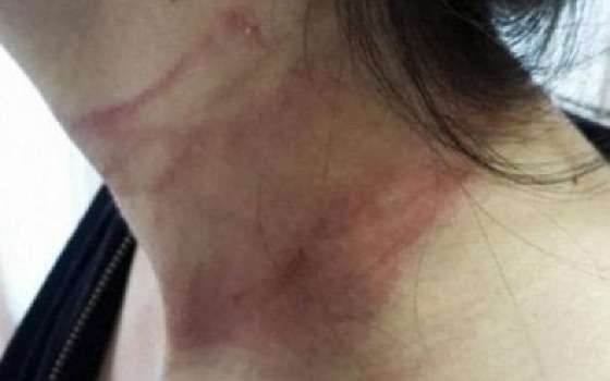 mulher enforcada